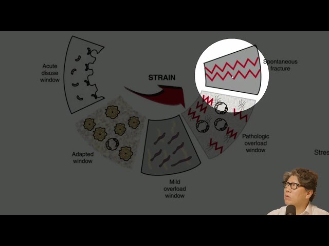 Implant Design과 교합력, 그리고 골 조직의 bio-reactive balances – 하